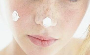 激光祛斑后會不會反彈