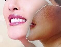 蜂巢皮秒祛斑會反彈嗎