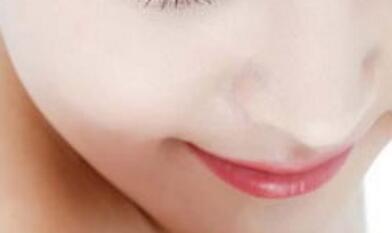 激光祛斑后如何保養(yǎng)皮膚