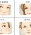 臉上長斑怎么快速去除