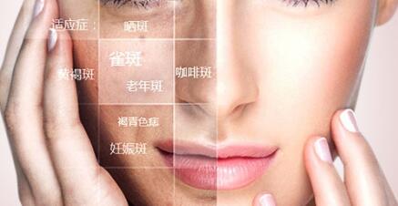 快速美白祛斑什么方法比較好