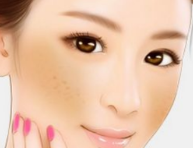 激光祛斑大概要多少錢