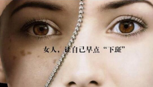 激光祛斑會有后遺癥嗎