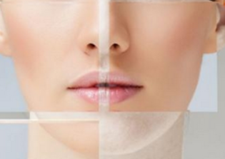 激光祛斑過程痛嗎