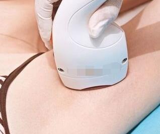 激光脫毛后還會(huì)再長嗎