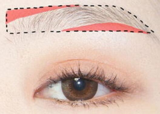 紋眉后注意事項都有哪些