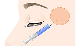 玻尿酸豐太陽穴安全嗎