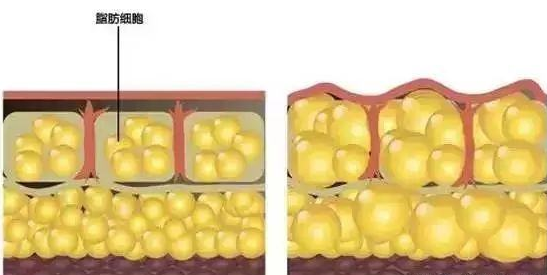 自體脂肪面部填充要多少錢