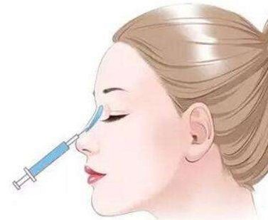 玻尿酸隆鼻一年后變寬怎么辦