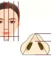 鼻翼縮小手術的后遺癥明顯嗎