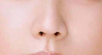 鼻翼縮小手術會影響正常的呼吸嗎