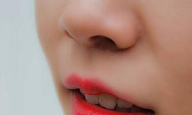 做鼻翼縮小手術(shù)后要休息多久