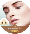 鼻翼縮小手術恢復期間要注意的護理事項