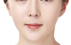 做鼻翼縮小手術(shù)會影響鼻子健康嗎