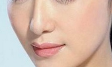 隆鼻用哪一種材料會(huì)比較好呢