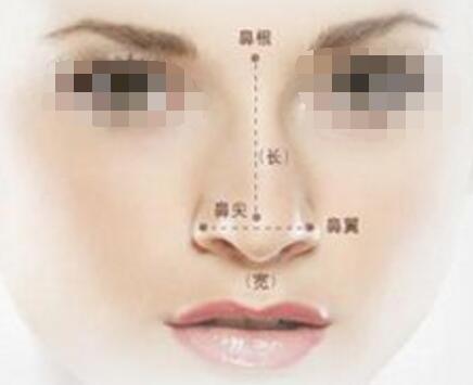 假體隆鼻手術(shù)術(shù)后的保養(yǎng)事項(xiàng)