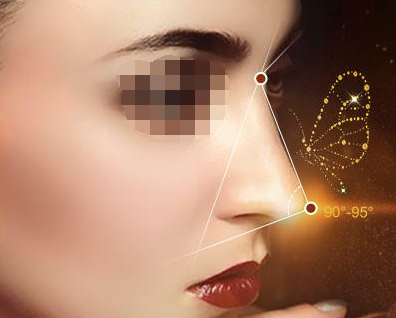 假體隆鼻手術(shù)失敗修復(fù)的價格貴嗎