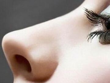 假體植入鼻部后老了要取出來嗎