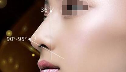 假體隆鼻需要注意的風(fēng)險