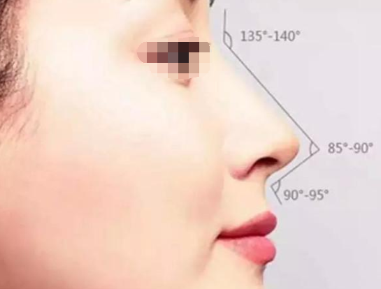 假體隆鼻的效果可以保持多少年