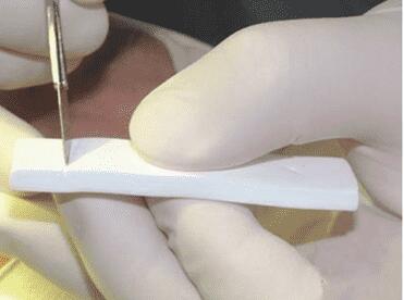 選擇假體隆鼻材料要考慮什么