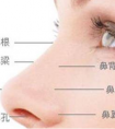 假體隆鼻后怎么護(hù)理比較好