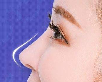 假體隆鼻多少天可以上班