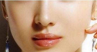 自體軟骨隆鼻有什么缺點(diǎn)嗎