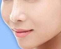 在廣州做自體軟骨隆鼻要多少錢