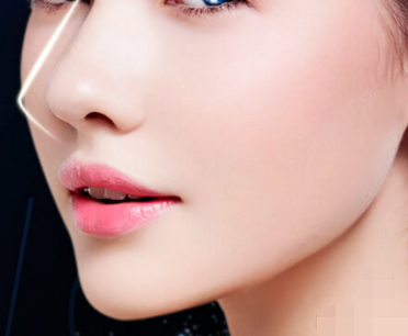 自體軟骨墊鼻梁會(huì)被吸收嗎