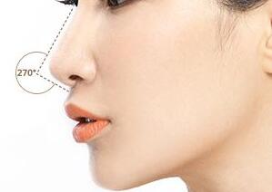 軟骨隆鼻多少天能消腫