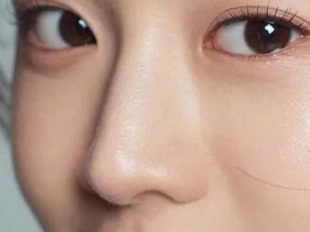 耳軟骨隆鼻會(huì)不會(huì)被吸收