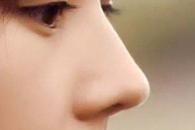 綜合隆鼻的恢復期是多久