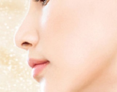 肋軟骨隆鼻術(shù)后會被吸收嗎