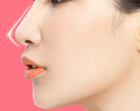 軟骨隆鼻后多久可以上班