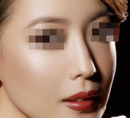 軟骨隆鼻多久才能穩(wěn)定下來