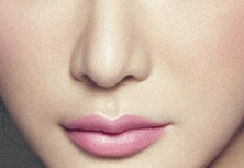 自體軟骨隆鼻多久可以拆線