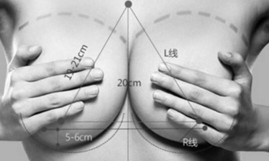 假體隆胸多久按摩不痛