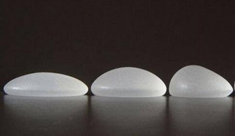 假體隆胸術后的痛感明顯嗎