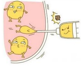 吸脂減肥手術(shù)要注意哪些風(fēng)險(xiǎn)問題