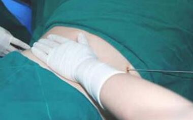 肚子上的脂肪怎么快速減掉