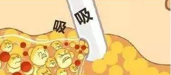 臉部吸脂的風險大不大