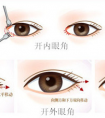 做開眼角手術(shù)的風(fēng)險大不大