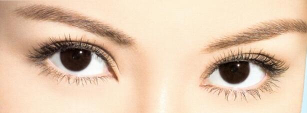 開眼角失敗了還能恢復(fù)嗎