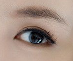 開眼角手術(shù)失敗會有什么癥狀嗎