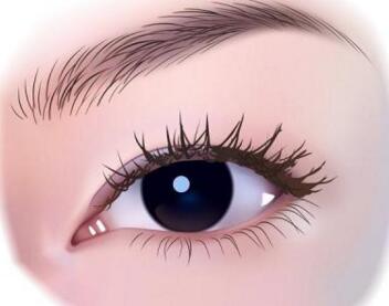 開眼角手術(shù)失敗會有什么癥狀嗎