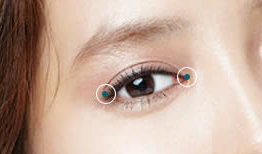 每個(gè)人都能開(kāi)眼角嗎