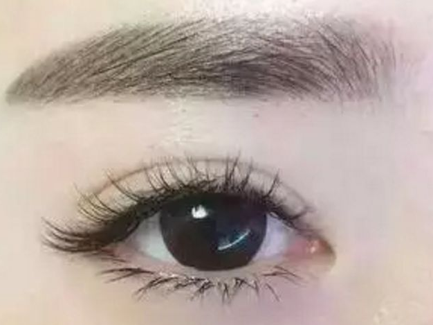 開(kāi)眼角后多久能上班