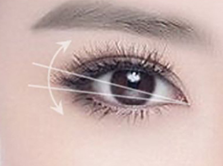 開眼角手術(shù)痛不痛