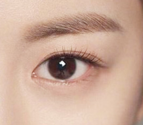 開眼角后多久可以上班